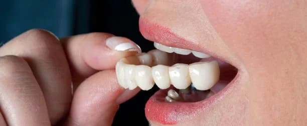 A woman putting an all ceramic full cast in her mouth